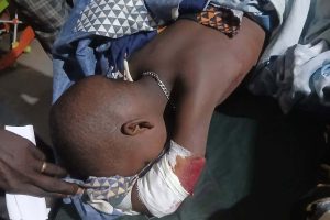 BREAKING NEWS: Tragic Attack in Jabjab Two Chikdren Injured: Eyewitnesses Point to EthnicTensions.